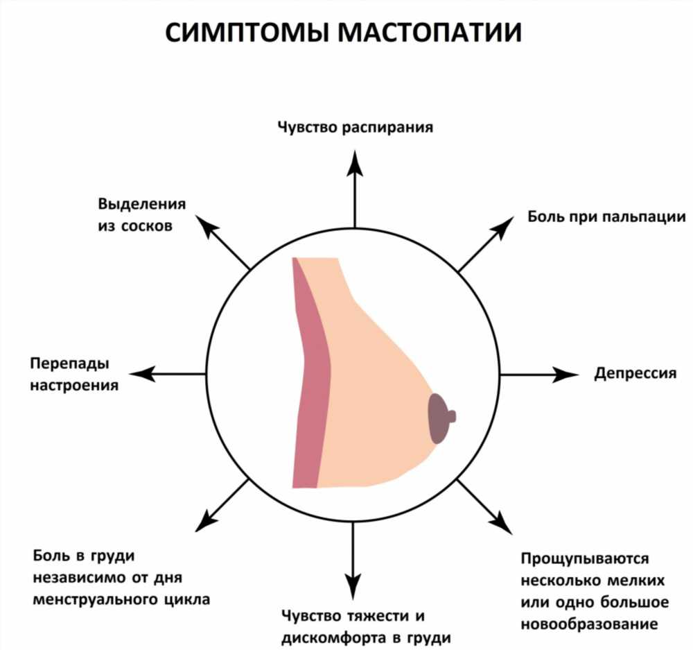 Мастопатия: причины, симптомы и методы лечения